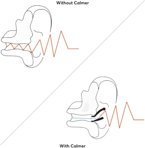 Flare CALMER® - Your Capability Store