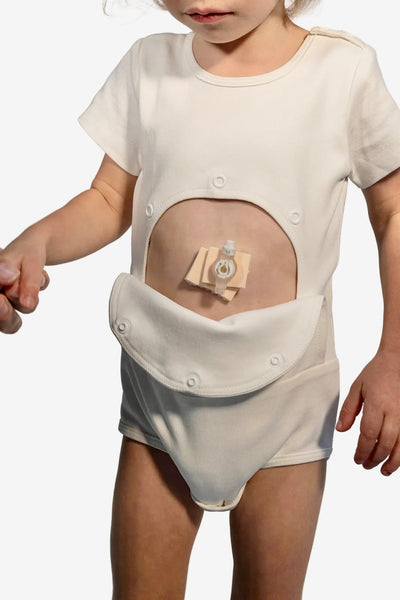 Adaptive PEG Short Sleeve Bodysuit - Your Capability Store